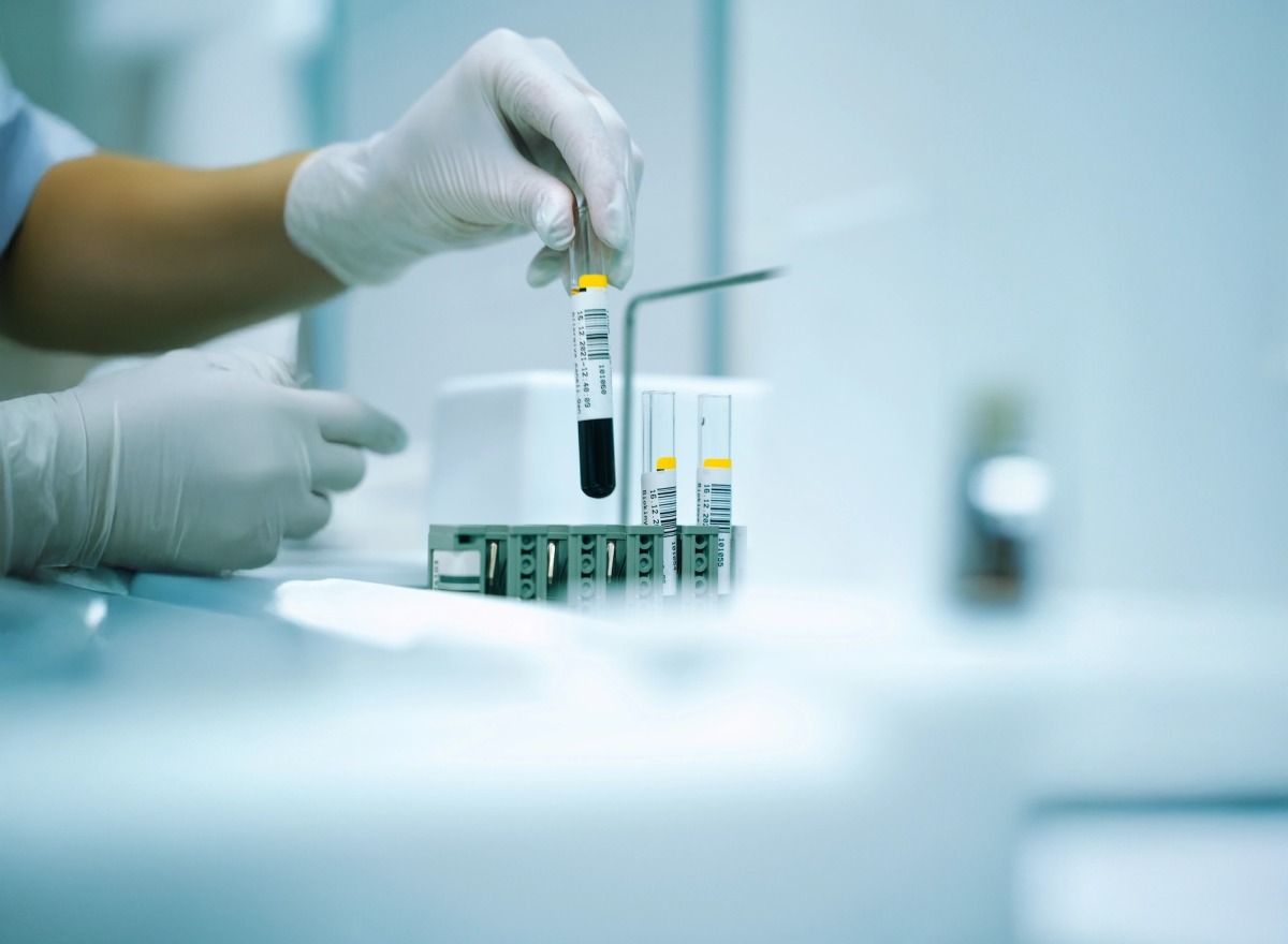 Tudatos felkészülés az edzéshez - Miért fontos a laborvizsgálat?